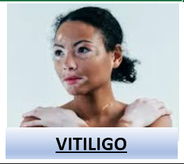 Captura De Pantalla 2025 04 14 112929 — Rasgos Atractivos option 30