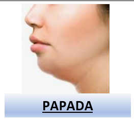 Captura De Pantalla 2025 04 14 113657 — Rasgos Atractivos option 65