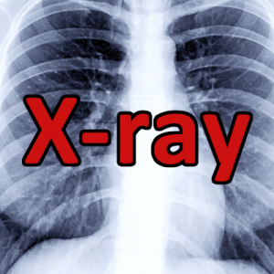 Xray — H-Tag Tier List option 25