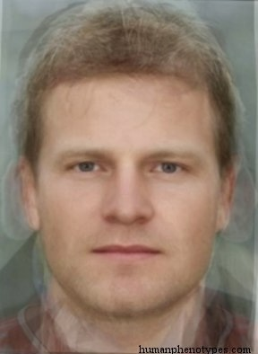 Zzzzz 1743279906img4511 — White Male Phenotype PSL option 24