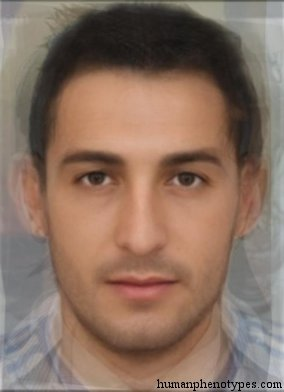 Zzzzz 1743285820img4585 — White Male Phenotype PSL option 37