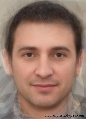 Zzzzz 1743285820img4588 — White Male Phenotype PSL option 40