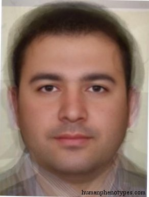 Zzzzz 1743285820img4592 — White Male Phenotype PSL option 44