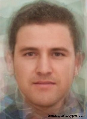 Zzzzz 1743285820img4593 — White Male Phenotype PSL option 45