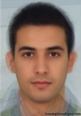 Zzzzz 1743285820img4595 — White Male Phenotype PSL option 53