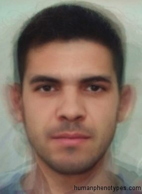 Zzzzz 1743287441img4601 — White Male Phenotype PSL option 56