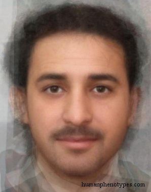 Zzzzz 1743311600img4642 — White Male Phenotype PSL option 61