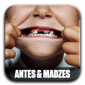 Zzzzz 177196013508 Antes — ALBUM RAP FR 2025 ! (900 projets) option 678