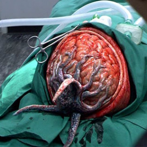 Zzzzz 1779805767brain Parasite — Doctor Who Monsters/Aliens/Villains option 755