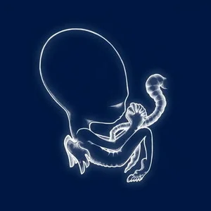 Sigur Rs Gtis Byrjun Cover Art — Top RYM Albums, Mixtapes, etc and also some other stuff option 185