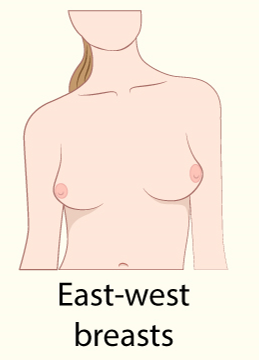 Breast shapes Tier List (Community Rankings) - TierMaker