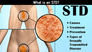 F691e9f1db5bf9442acf2294cae00d7dpng — STD tierlist option 10