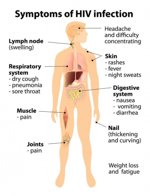 Symptoms Of Hiv Infectionjpg — STD tierlist option 15