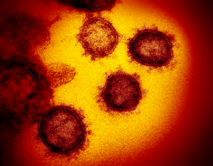 Sarsjpg — Viruses And Diseases option 16